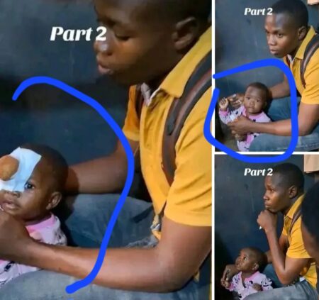 Shock As Kampala Man Seeking Financial Help For Daughter’s Cancer Treatment Is Exposed Over Alleged Artificial Eye Wound